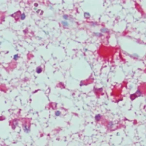 IDH1 R132H(Isocitrate Dehydrogenase 1)