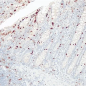 CD103