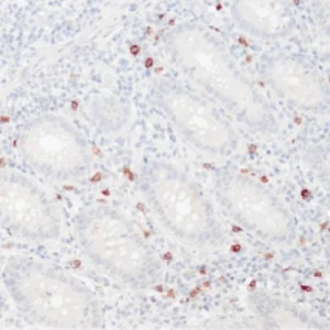 CD117(c-kit)