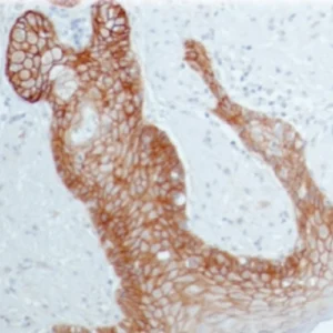 EGFR(Epidermal Growth Factor Receptor)