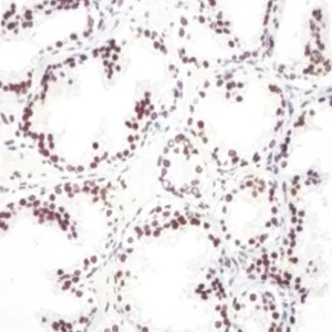 AR(&rogen Receptor)