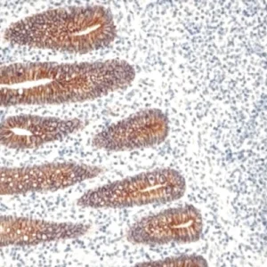 Cadherin E