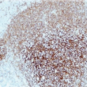 CD21