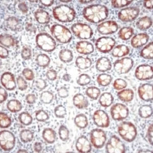 Cdk4