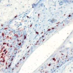 CD207(Langerin)