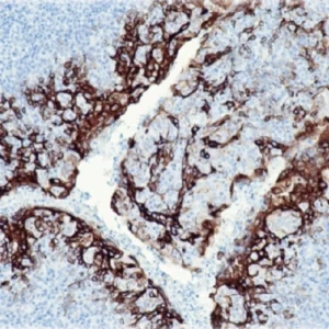 Cytokeratin 6
