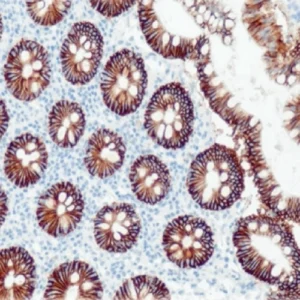 Cadherin 17