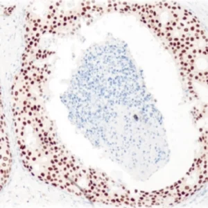 ER(Estrogen Receptor)