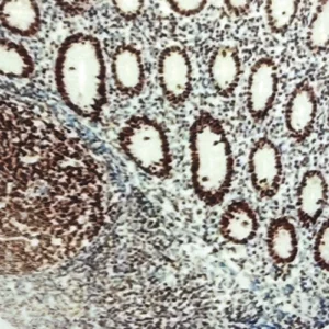 SMARCA4(BRG1)