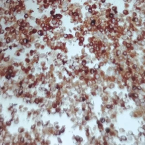 ROS1(Proto-Oncogene Tyrosine-Protein Kinase ROS)