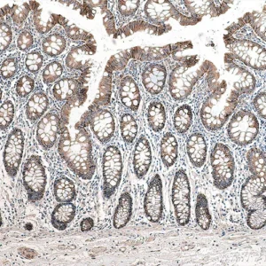CD326(Ep-CAM)
