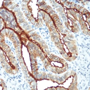 FOLR1(Folate Recepetor Alpha)