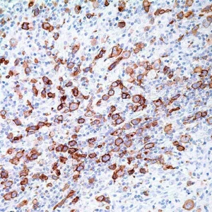 CD30